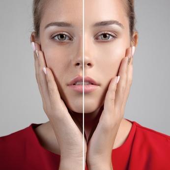 VISAGE IMPERFECTIONS